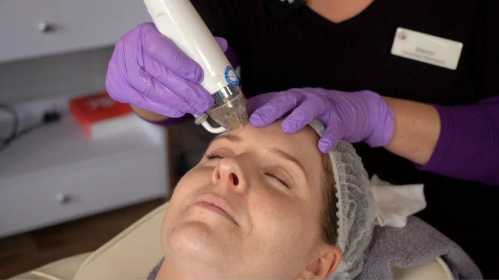 Recovery guide for rf micro needling radio frequency before and after. 