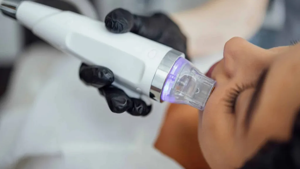 Know how many Secret RF treatments may be required for long-lasting skin rejuvenation results. 