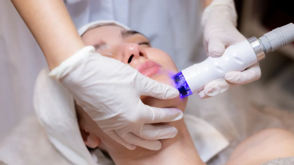Secret RF vs Potenza treatment options for sensitive skin.
