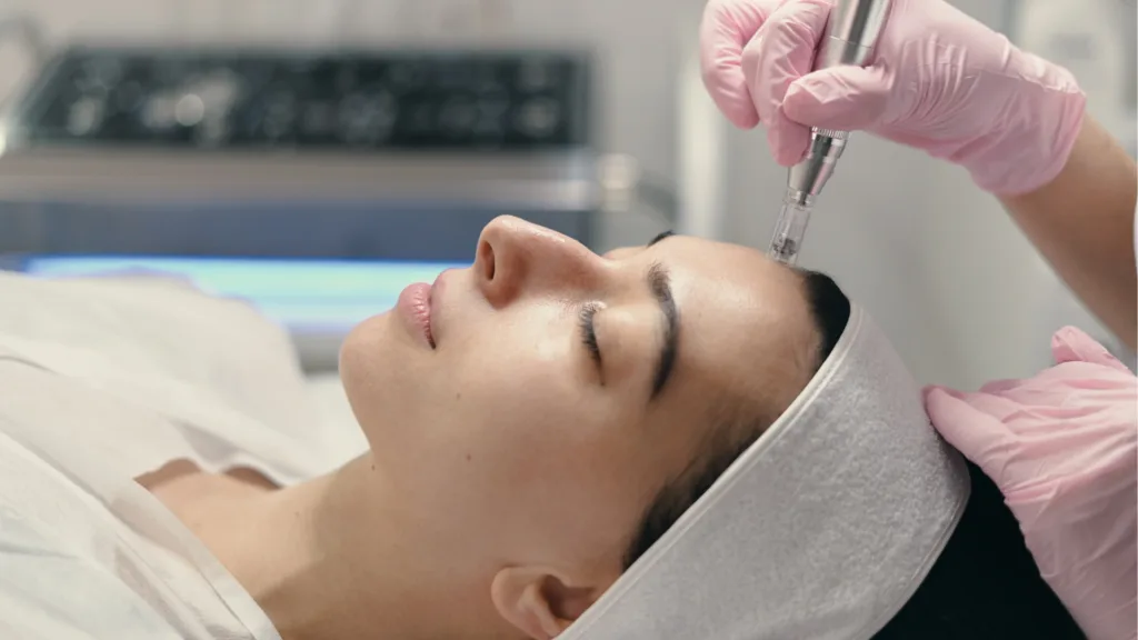Sqt bio microneedling price in Canada.