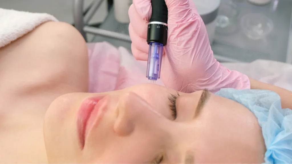 Know what is microneedling and bio oil in skincare routine for skin treatment.
