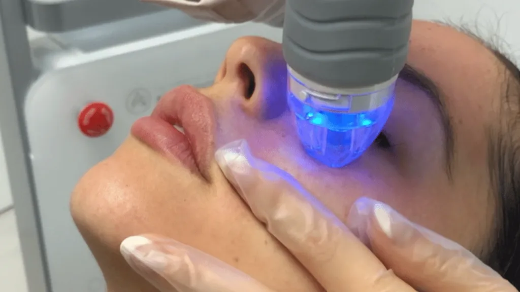 Secret RF post care supports gradual skin tightening and renewal.