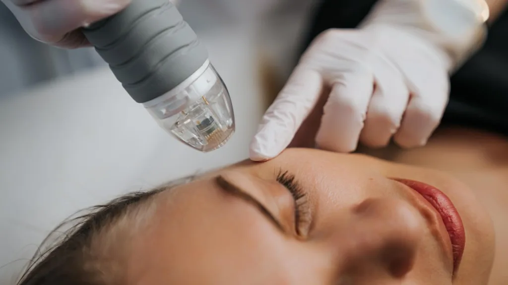 Secret RF aftercare information and treatment guidance.