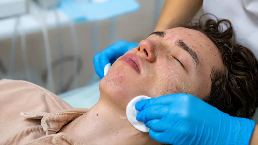 Comparing Morpheus8 vs Secret RF for acne scars and deep skin remodeling.