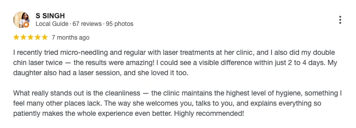 Common positive reviews shared by patients for Secret RF microneedling before and after treatment experience.