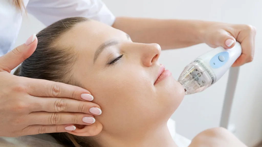 Secret RF pain after treatment information and recovery guidance.