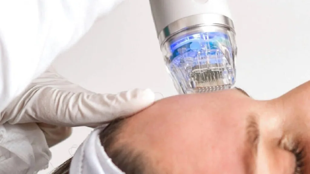 Secret RF pain concerns and treatment experience information.