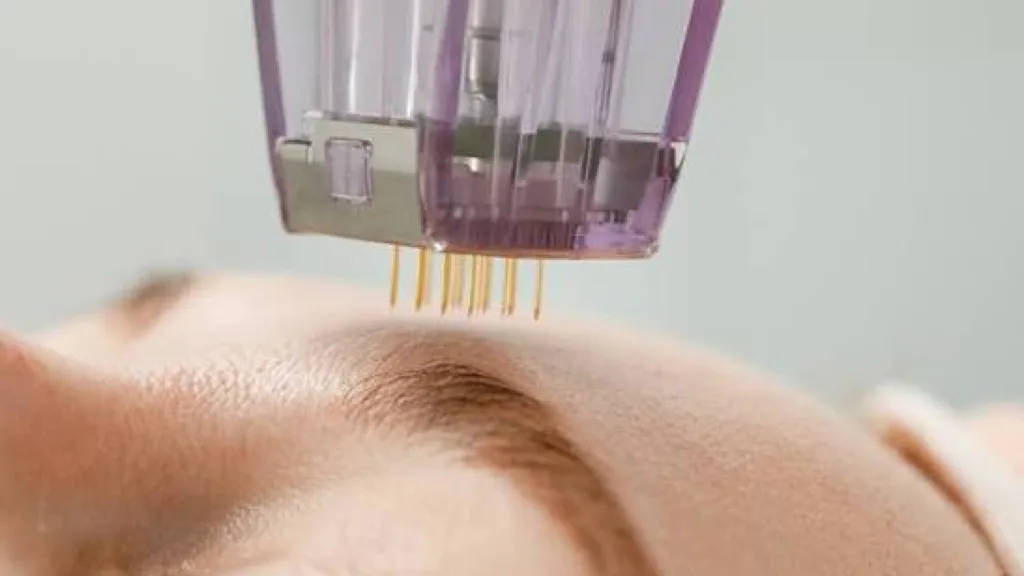 Secret RF post care guidelines for healthy skin routine and tips.