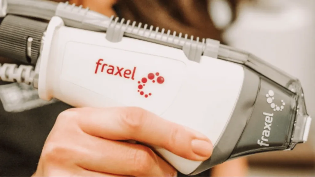 Secret RF vs Fraxel cost expectations and treatment pricing comparison.