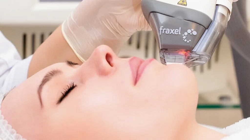 Secret RF vs Fraxel for uneven skin tone treatment.