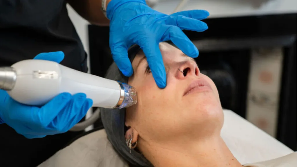 Secret RF vs Genius RF treatment results timeline and recovery expectations. 