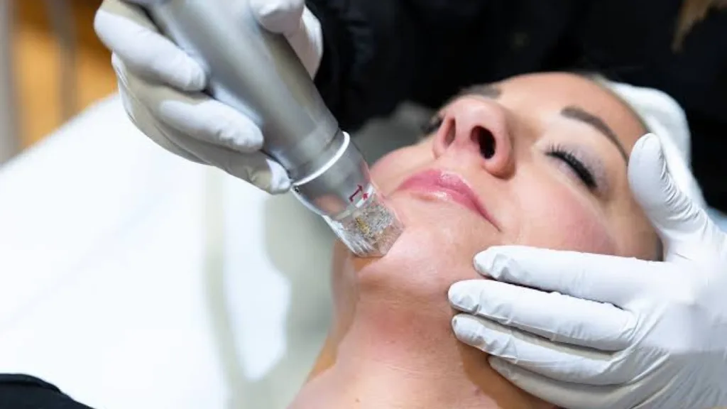 Ideal candidate considerations for Scarlet RF and secret rf vs scarlet rf treatment comparison.