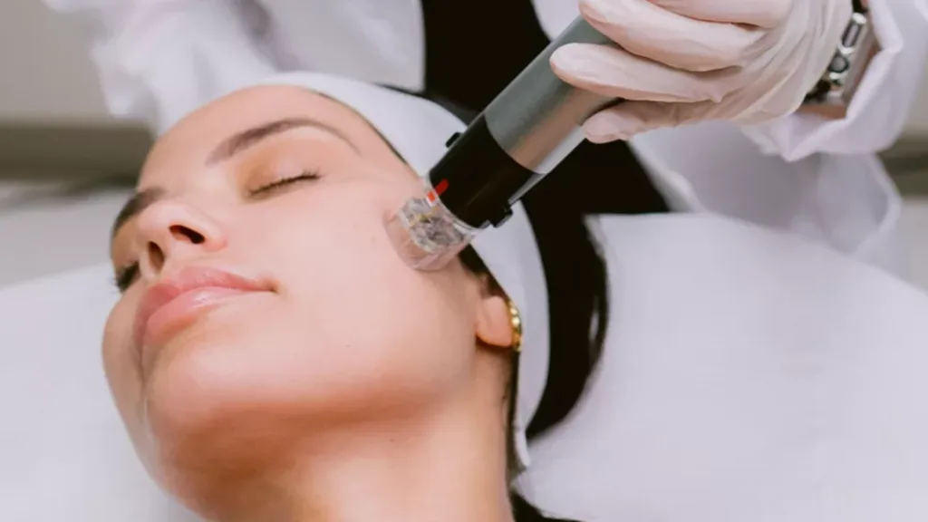 Secret RF aftercare guidance for temporary skin sensitivity.