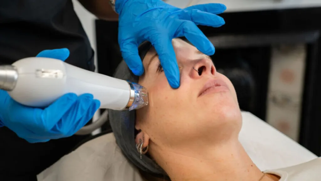 Secret RF vs Scarlet RF treatment comparison for different skin types.