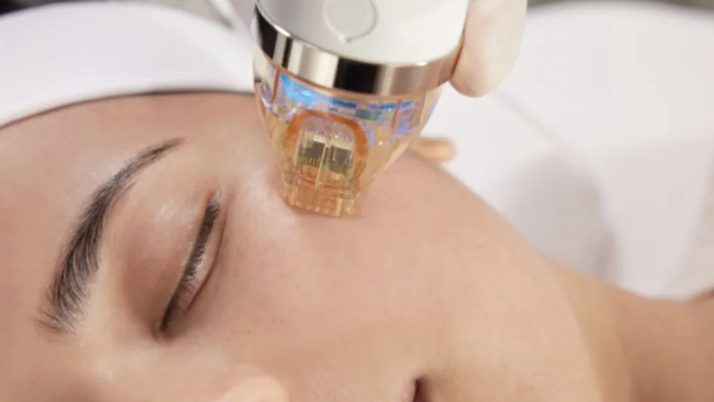 Know what is Secret RF microneedling vs Vivace treatments. 